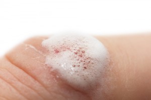 Did you know there's more to hydrogen peroxide than just cleaning wounds? Via Shutterstock. 